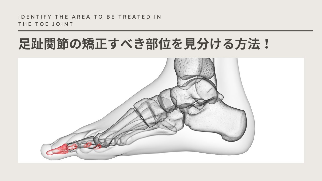 足指関節の矯正すべき部位を見分ける方法！